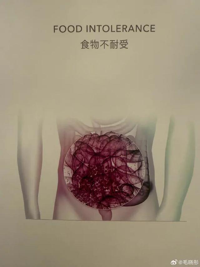 开云在线-演员毛晓彤凌晨从医美诊所离开引网友热议，其晒医院检测报告回应：作为一个从小爱吃面食的天津人，查出面粉不耐受可怎么办